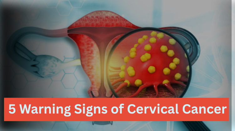 5 Warning Signs of Cervical Cancer