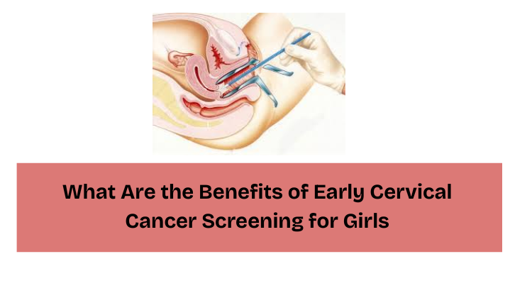 Early Cervical Cancer Screening for Girls