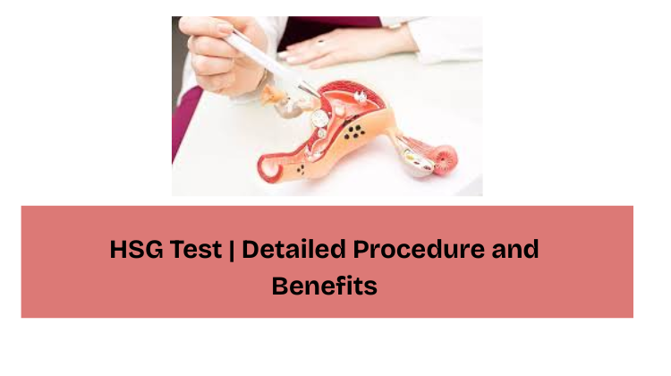 HSG Test